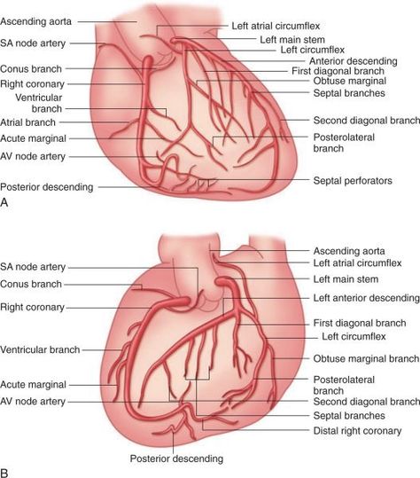 Cath Lab Nursing, Cardiac Cath, Cath Lab Nurse, Arteries Anatomy, Cardiac Anatomy, Cardiology Nursing, Human Heart Anatomy, Coronary Artery, Interventional Radiology