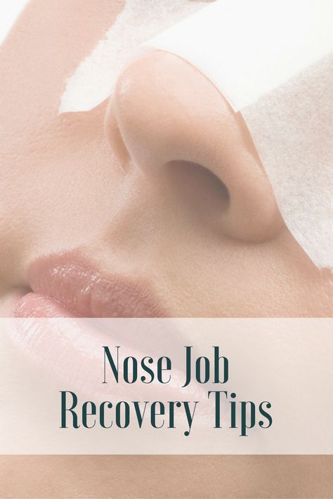 Rhinoplasty Recovery Timeline, Nose Job Recovery, Plastic Surgery Recovery, Rhinoplasty Recovery, Nose Surgery Rhinoplasty, Rhinoplasty Nose Jobs, Rhinoplasty Surgery, Eyelid Lift, Lip Augmentation