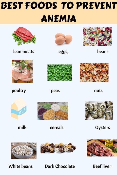 Iron Sources Food, Foods For Iron, Food For Iron Deficiency, Iron Deficiency Diet, Anemic Diet, Hemoglobin Rich Foods, Iron Diet, Vitamin Rich Foods, Foods With Iron