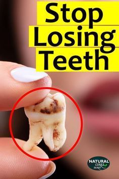 Cavity Remedy, Grow Back Receding Gums, Whiten Teeth Fast, Baby Bottle Tooth Decay, Losing Teeth, Tooth Cavity, Heal Cavities, Healthy Lungs, Dental Cavities