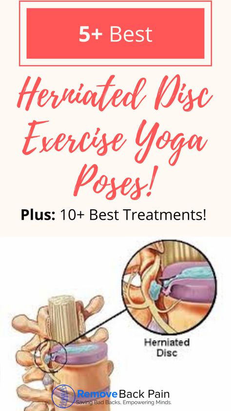 L5 S1 Exercises, Lower Back Pain Stretches, Disk Herniation, Bed Workout, Bulging Disc, Back Stretches For Pain, Exercise Yoga, Living Your Best Life, Neck Stretches