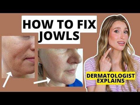 How to Fix Jowls: Dermatologist Explains How to Prevent & Get Rid of Jowls | Dr. Sam Ellis - YouTube Saggy Jowls Exercise, How To Get Rid Of Saggy Jowls, How To Get Rid Of Jowls Sagging Skin, How To Get Rid Of Jowls Naturally, Get Rid Of Jowls The Face, How To Get Rid Of Jowls, Jowls Sagging, Jowl Exercises, Facial Exercises For Jowls