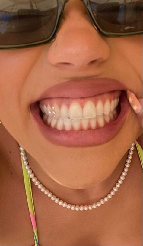 Pretty Teeth, Dental Jewelry, Tooth Jewelry, Grillz Teeth, Windows To The Soul, Diamond Teeth, Tooth Gems, Grills Teeth, Perfect Teeth