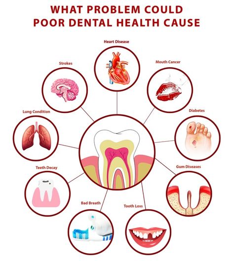 What problem could poor dental health cause. You should about your dental care. Lung Conditions, Dentist Visit, Hearing Problems, Health Poster, Brain Tissue, Gum Health, Chronic Disease, Tooth Decay, Overall Health