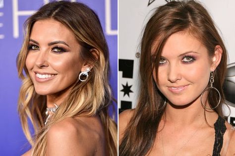 Audrina Patridge's changing face - How The Hills star ... Eyebrow Lift, Anti Wrinkle Injections, Audrina Patridge, Arched Eyebrows, Lauren London, Hayden Panettiere, Kelly Rowland, Ashley Tisdale, Christina Milian