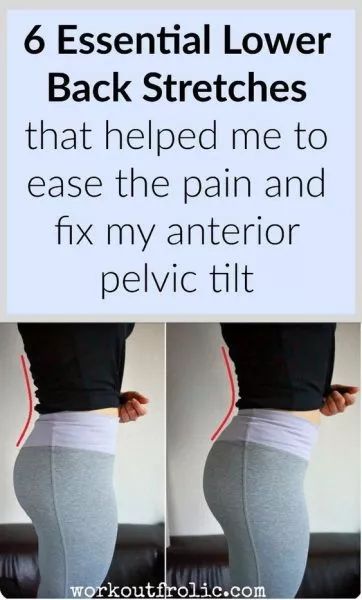 Anterior Pelvic Tilt Stretches To Relieve Lower Back Pain Lower Back Stretches, Anterior Pelvic Tilt, Stretching Routine, Low Back Stretches, Pelvic Tilt, Stretch Routine, Hip Flexor Stretch, Planet Fitness, Yoga Iyengar