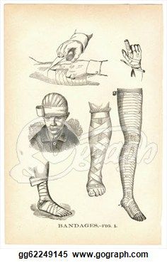 i like the style this is drawn in Bandaging Wounds, Medical Anatomy, Vintage Medical, Wound Care, Antique Paper, Medical Illustration, Figure Drawing Reference, Lithograph Print, Title Page