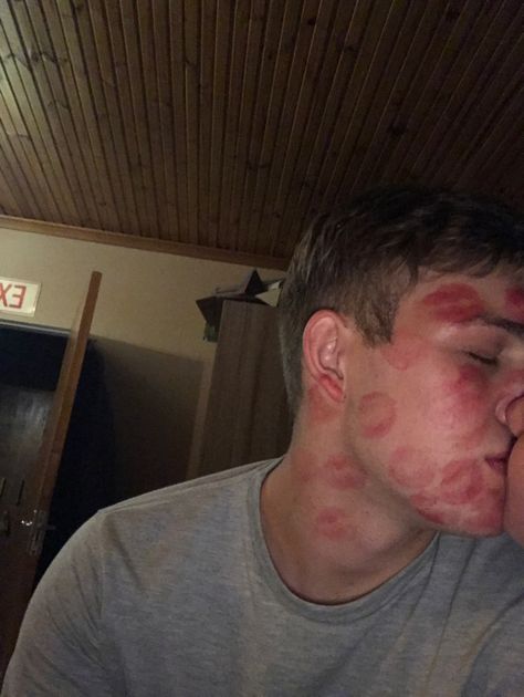 Couple goals, lipstick kisses, boyfriend, aesthetic Face Covered In Kiss Marks, Lipstick Marks On Boyfriend Face, Guy Covered In Kiss Marks, Swollen Lips After Kiss, Lipstick On Boyfriend Face, Kiss Marks On Boyfriend, Face Full Of Kisses, Kiss Lipstick Aesthetic, Lipstick Stains On Boyfriend