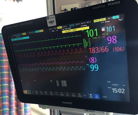 Hospital Heart Monitor, Svt Heart Condition, Hospital Monitor, Barbie Hospital, Hospital Core, Ecg Interpretation, Patient Monitor, Hospital Photography, Heart Monitor