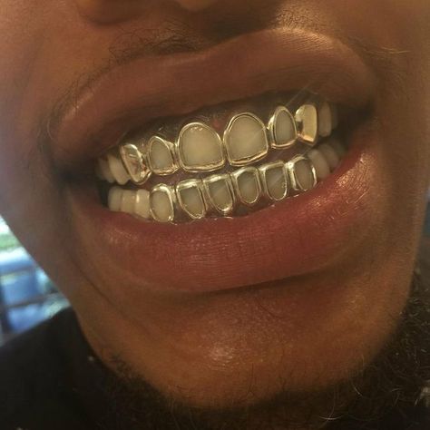 Gold Teeth Grills, Open Face Grillz, Pretty Teeth, Silver Grillz, Dental Jewelry, Grillz Teeth, Teeth Caps, Gold Grill, Diamond Teeth