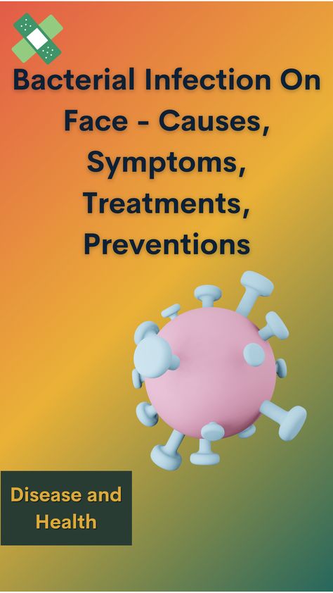 A bacterial infection can happen anywhere in your body. But they're especially common bacterial infection on face because that's where you have the most oil glands. 𝘙𝘦𝘢𝘥 𝘮𝘰𝘳𝘦 : https://rfr.bz/p3w2oks #bacterialinfectiononface #bacterialskininfectiononface #bacterialrashonface #bacterialskinrashonface Skin Rash On Face, Rash On Face, Fungal Infection Skin, Acid Reflux Diet, Sweat Gland, Passion For Life, Fungal Infection, Bacterial Infection, Medical Knowledge