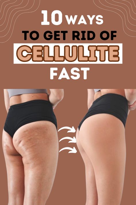 Tighten Buttocks Exercises, Workouts To Get Rid Of Cellilute Fast, Get Rid Of Cellilute Disease, How To Get Rid Of Leg Cellilute, How To Get Rid Of Cellilute Fast Diy, How To Get Rid Of Cellilute Fast, How To Get Rid Of Cellilute Fast Workout, How To Get Rid Of Back Fat Fast, Tighten Buttocks