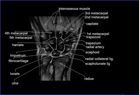 Mri Humor, Mri Physics, Mri Study Guide, Mri Anatomy, Anatomy Shoulder, Mri Images, Wrist Anatomy, Medical Diagrams, Mri Tech