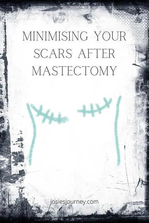 Here is what worked for me and some tips to help with minimising your scars after mastectomy too. Mastectomy Humor Funny, After Mascetomy, Mastectomy Scar Tattoo Flat, Flat Closure Mastectomy Tattoo, Going Flat After Mastectomy Fashion, Post Mastectomy Exercises, Aesthetic Flat Closure Mastectomy, Flat Closure Mastectomy, Mastopexy Recovery