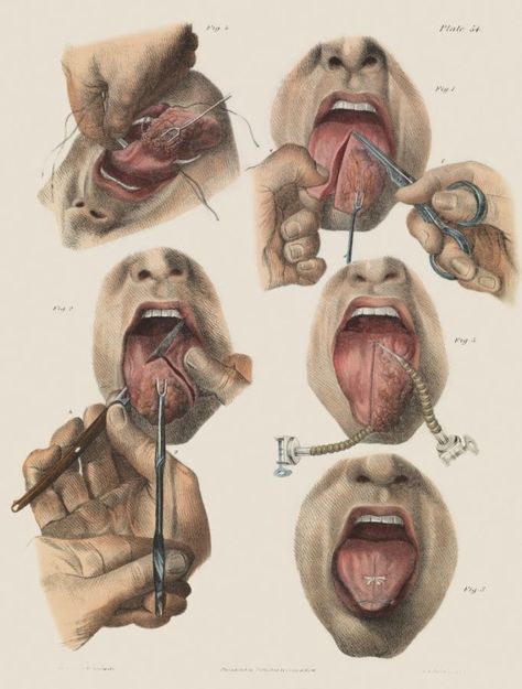 5 Terrifying Pictures, Medical Drawings, Vintage Medical, Medical Art, Medical Illustration, Medical History, Anatomy Art, Graphic Image, Victorian Era