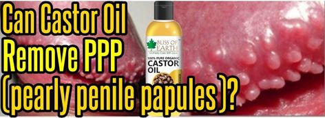 Castor Oil And Pearly Penile Papules...Find out More Kids Reading, Mens Health, 72 Hours, Castor Oil, Health Tips, Free Gifts, Pear, At Home, Pure Products