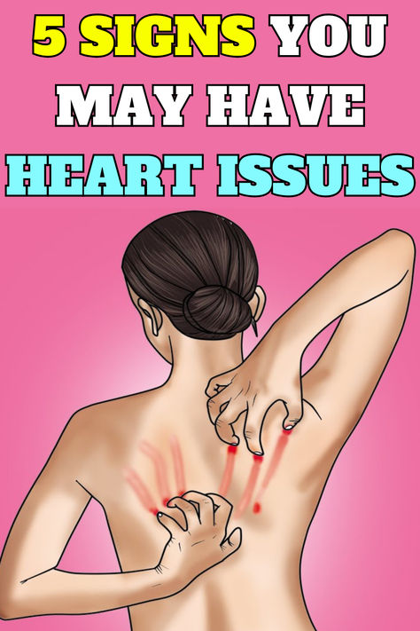 Signs of heart issues might include chest discomfort, shortness of breath, nausea, lightheadedness, cold sweats, and discomfort in the arms, which may vary from person to person. #heart #heartattack #healthyheart Tia Chi, Sick Quotes, Bad Advice, Chest Discomfort, What Is Health, Health Signs, Heart Problems, Shortness Of Breath, Medical Help