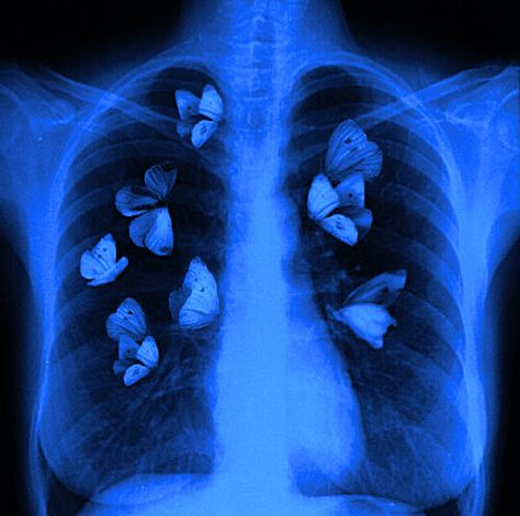 Lungs, Blue Aesthetic, Follow For More, Butterflies, Blue