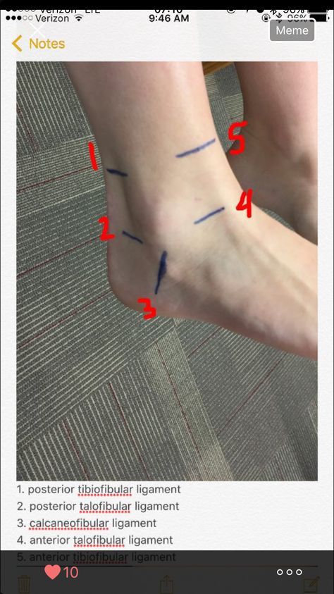 Ankle Ligaments, Pt School, Physical Therapy School, Physical Therapy Student, Physical Therapist Assistant, Physical Therapy Assistant, Pta School, Medical Student Study, Human Body Anatomy