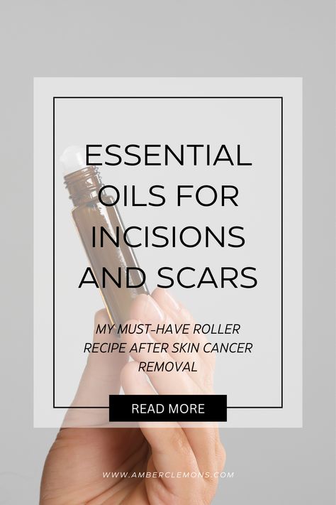 DIY Essential Oil Roller recipe for scars Scar Cream Essential Oils, Essential Oils For Scars After Surgery, Essential Oil For Scars, Yarrow Essential Oil, Oils For Scars, Lighten Scars, Scar Cream, Face Care Routine, Oil Roller