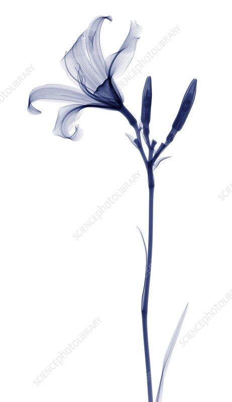 Ray Tattoo, Lily Tattoo, Science Photos, Photo Library, X Ray, Flower Tattoo, Flower Art, Art Tattoo, Stock Images