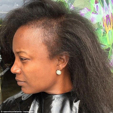 Atlanta hairstylist shares videos of clients suffering from hair loss due to weaves Damaged Black Hair, Razor Chic Of Atlanta, Razor Chic, Short Weave Hairstyles, Alopecia Hairstyles, Traction Alopecia, Tan Skin Blonde Hair, Hair Issues, African American Hairstyles