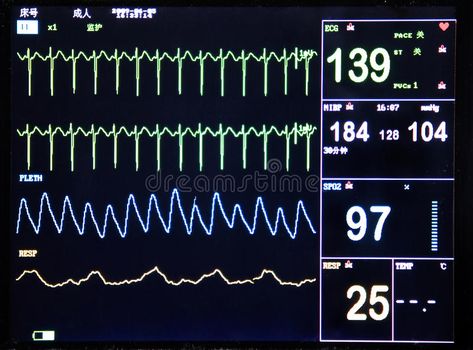 Heart Monitor Aesthetic, Heartbeat Monitor Aesthetic, Hospital Monitor, Hospital Heart Monitor, Heart Room, Heart Monitor, Iv Fluids, About Heart, Hospital Room