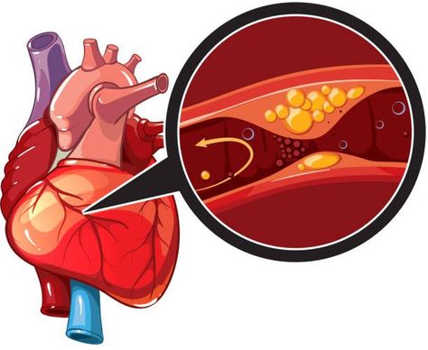 Vascular Surgery, Heart Valves, Congenital Heart Defect, Heart Palpitations, Congenital Heart, Chronic Obstructive Pulmonary Disease, Coronary Arteries, Pulmonary Disease, Healthy Heart