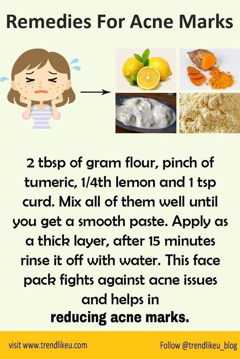 Remedies For Acne, Remedies For Glowing Skin, How To Reduce Pimples, Ingrown Toenail, Clear Skin Face, Skin Face Mask, Clear Healthy Skin, Glowing Skin Mask, Natural Face Skin Care