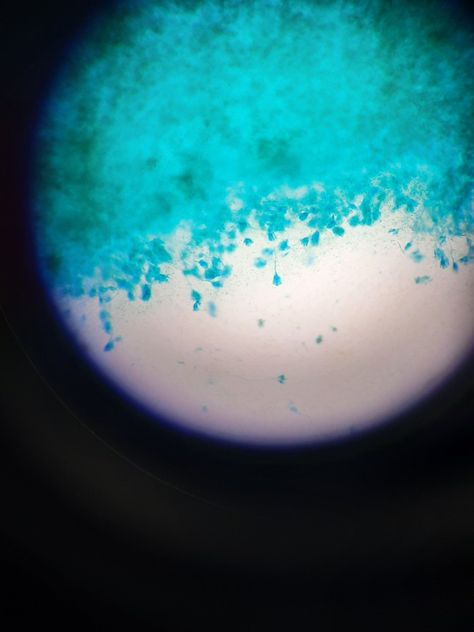 Penicillin is extracted from this fungi called Penicillium Chrysogenum. It's used as an antibiotic and it attacks bacteria's cell walls. #bio #stem #biology #microbiology #microscope Stem Biology, Under Microscope, Cell Wall, Microbiology, Biology