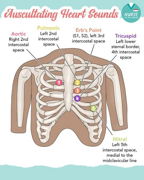 Kristine Tuttle on Instagram: "-Auscultating Heart Sounds- 1️⃣Aortic: Right 2nd intercostal space 2️⃣Pulmonic: Left 2nd intercostal space 3️⃣Erb’s Point: (S1, S2), Left 3rd intercostal space 4️⃣Tricuspid: Left lower sternal border, 4th intercostal space 5️⃣Mitral: Left 5th intercostal space, medial to the midclavicular line It can be tricky doing your first few head-to-toe assessments in a clinical setting. The Complete Nursing School Bundle includes information presented in many different ways: using comparison charts, memory tricks, mnemonics & illustrations designed to help you truly grasp & learn the information! 🫀What mnemonic do you use to remember the areas of listening to the heart? #nursingschool #nursingnotes #auscultation #heartsounds #nurseshelpingnurses" Heart Assessment Nursing, S1 And S2 Heart Sounds Nursing, S1 S2 Heart Sounds, Heart Auscultation Points, Lung Auscultation Landmarks, Apical Pulse Location, Cardiac Assessment Nursing, Central Line Nursing, Auscultation Heart