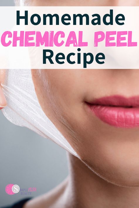 Mary Kay Facial Peel, Diy Facial Peel, Diy Chemical Peel, Nose Peeling, Diy Peel Off Mask, Chemical Face Peel, Best Chemical Peel, Face Peel Mask, Chemical Peel At Home