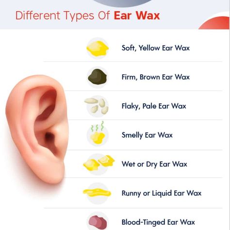 Clogged Ear Remedy, Clean Ear Wax Out, Impacted Ear Wax, Blocked Ears, Ear Pimple, Ear Cleaning Wax, Clogged Ears, Ear Wax Buildup, Ear Candling