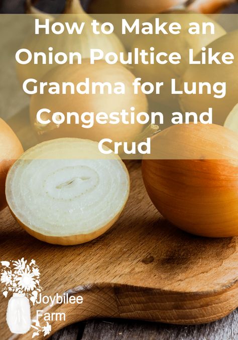 An onion poultice is a simple and historical folk remedy to relieve lung congestion, pneumonia, and coughs. It works against bacteria and helps your body break up mucus and congestion. This poultice can be made at home in just a few minutes, and is gentle enough for adults and children. Nature, Natural Remedies For Pneumonia, Onion Poultice, Pneumonia Remedies, Congestion Remedies, Best Cough Remedy, Cough Medicine, Sick Remedies, Home Remedy For Cough