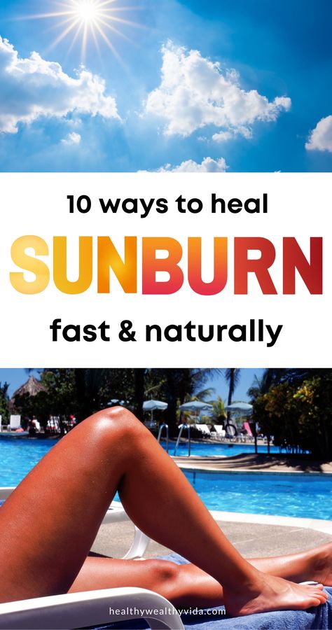 Burned Skin Remedies, Heal Sunburn Fast, Sunburn On Face, Best Remedy For Sunburn, Really Bad Sunburn, Best For Sunburn, How To Help Sunburn, Sunburn Face, Home Remedies For Face