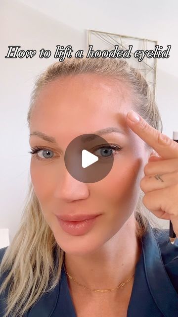 Botox Eye Lift, Botox For Hooded Eyes, Eyebrow Botox Lift, Botox Eyebrow Lift Before And After, Botox Smile Lift, Eyebrow Lift Botox Before And After, Botox For Hooded Eyelids, Lift Eyelids, Eyelid Lift Surgery Before After