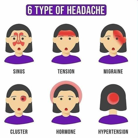 Fashion| Art| Diy| Beauty Tips on Instagram: “Types of headache.. Double tap to like❤❤ And tag your friends.. & do comments.. Dm for credit or removal🙏 #healthgoals2021…” Types Of Headache, Headache Chart, English Words Vocabulary, Tension Migraine, Sinus Migraine, Diy Beauty Tips, Health Corner, Headache Types, Reflexology Chart