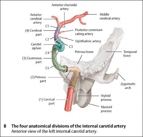 Segments of the ICA Vascular Anatomy, Aortic Arch, Arteries Anatomy, Anatomy Head, Nervous System Anatomy, Vascular Ultrasound, Internal Carotid Artery, Parts Of The Brain, Vertebral Artery