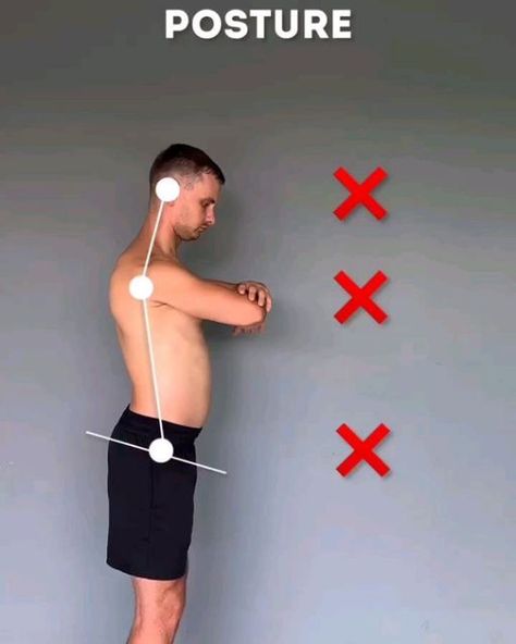 Fix Bad Posture, Workout Back, Fix Your Posture, Correct Posture, Posture Exercises, Fitness Pilates, Health Workout, Pilates Fitness, Bad Posture