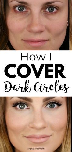 Cover Dark Circles, Dark Circles Makeup, Angela Lanter, Under Eye Makeup, Hide Dark Circles, Dark Eye Circles, Covering Dark Circles, Dark Circles Under Eyes, Concealer Makeup