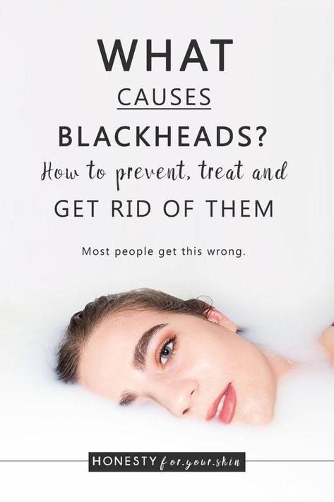 Are you ready for this? What causes blackheads? How to prevent blackheads and is it okay to squeeze blackheads? Come learn all my skin savvy in the making... What Causes Blackheads, How To Prevent Blackheads, Cold Medicine, Home Remedy For Cough, Cold Sores Remedies, Natural Sleep Remedies, Natural Health Care, Natural Cold Remedies, Get Rid Of Blackheads