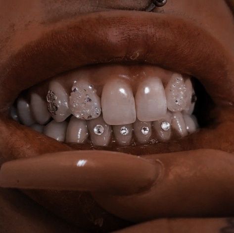 Teeth Jewels, Teeth Accessories, Pretty Teeth, Grillz Teeth, Diamond Teeth, Big Box Braids, Tooth Gems, Gold Grillz, Grills Teeth