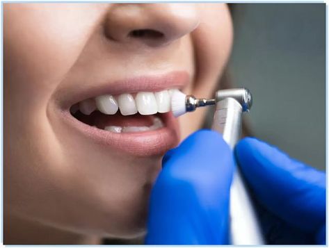 Teeth Cleaning Deep Teeth Cleaning, Kedokteran Gigi, Dental Veneers, Dental Teeth, Dental Cleaning, Periodontal Disease, General Dentistry, Best Dentist, Dental Services