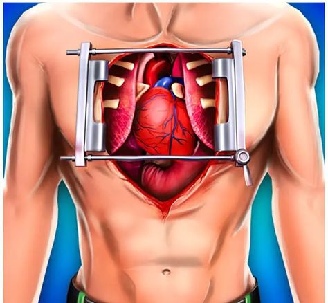 Discover the essential steps and insights for a successful open heart surgery recovery. Your path to healing starts here. - #Cardiacprocedurerecuperation #Cardiacsurgeryrecovery #Cardiacsurgeryrecoveryprocess #Copingwithheartsurgeryaftermath #Emotionalhealingaftercardiacsurgery #Healingafteropenheartsurgery #Heartoperationrecovery #Heartsurgeryrehabtips #Physicaltherapyforheartsurgeryrecovery... Open Heart Surgery Recovery, Heart Surgery Recovery, Crazy Nurse, Abdominal Aorta, Emergency Doctor, Heart Valves, Open Heart Surgery, Heart Surgery, Surgery Recovery