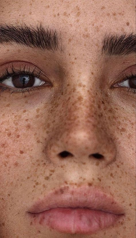 Black And White Freckles Photography, Makeup That Shows Freckles, Olive Skin Freckles, Freckles Aesthetic Faceless, Freckles Across Nose, Arm Freckles, Lip Freckles, Face Close Up, Freckles On Nose