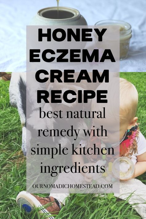 Best Remedy for Eczema: Honey Eczema Cream Recipe - Our Nomadic Homestead Excema Remedies Diy, Healing Salve Recipe, Lip Care Tips, Healing Salve, Salve Recipes, Kitchen Ingredients, Homemade Lotion, Skin Detox, Simple Kitchen