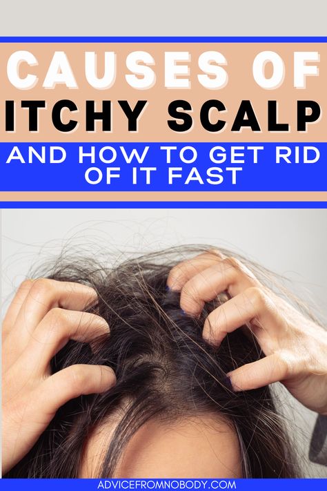 Causes Of Dandruff, Scalp Dryness Remedies, Soothe Itchy Scalp, Flaky Hair Remedies Dry Scalp, Natural Remedies For Itchy Scalp, Best Oil For Dry Scalp, Dandruff And Itchy Scalp Remedy, Scalp Care Itchy, Dry Itchy Scalp Remedy Diy