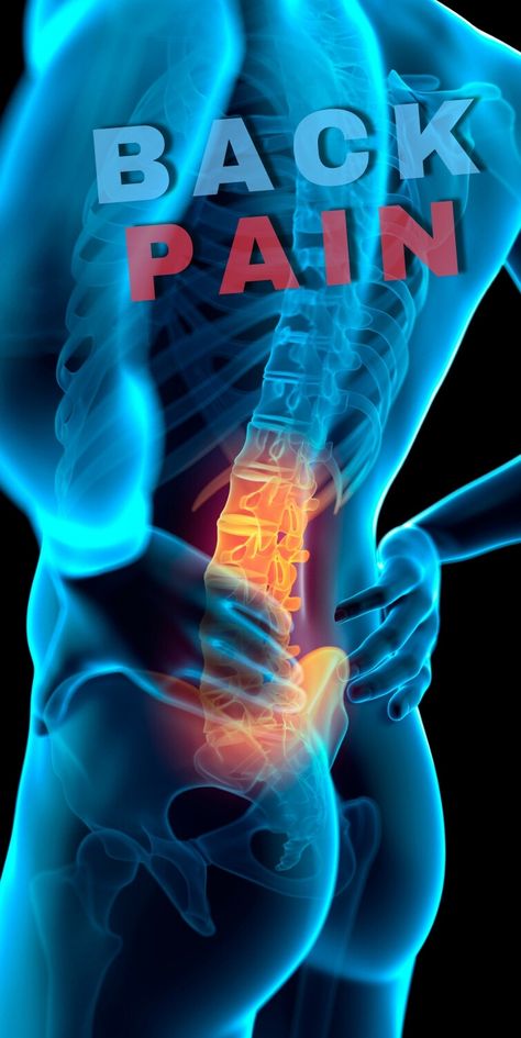 Pain on the Right Side of the Back: Explained: Learn why you might have pain on the right side of your back. #backpain #backpaintherapy Sleep Positions, Chronic Back Pain, Causes Of Back Pain, Piriformis Syndrome, Back Hurts, Spine Health, Upper Back Pain, Muscle Strain, Relieve Back Pain