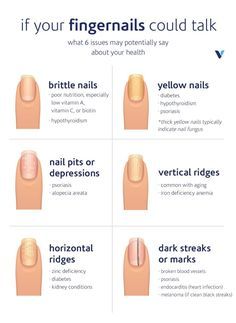 Often, our hair, skin, and nails reflect our interior health. Here are six common fingernail issues—and what they’re trying to tell you about your health. Nail Health Signs, Fingernail Health Signs, Fingernail Health, Emerald Nails, Opal Nails, Health Signs, Peinados Recogidos, Brittle Nails, Nail Growth