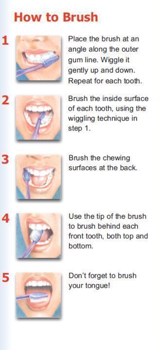 How to brush your teeth? Don't be surprised... We have to teach patients the proper technique everyday. It is important to use proper technique using soft strokes and a soft bristle brush. Harder is not better. If you don't want recession that is! Don't forget to massage the gums lightly and brush your tongue! #oralhygiene Brushing Your Teeth, Sikat Gigi, Brush Your Teeth, Oral Care Routine, Gum Care, Oral Health Care, Teeth Care, Bristle Brush, Dental Hygiene